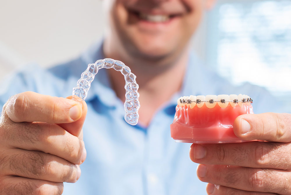 Comparing a clear aligner with traditional fixed braces