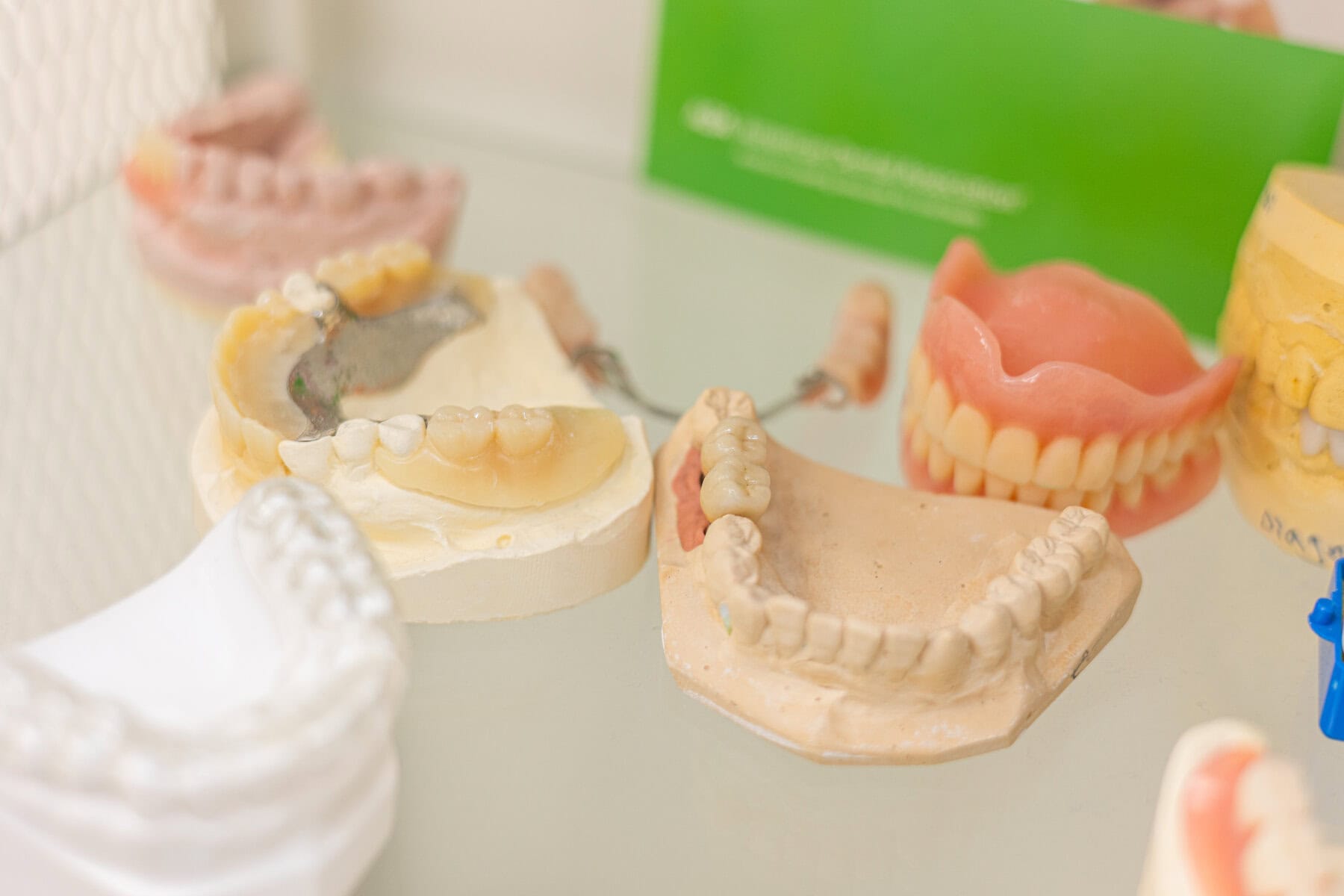 Denture and dental models in the laboratory