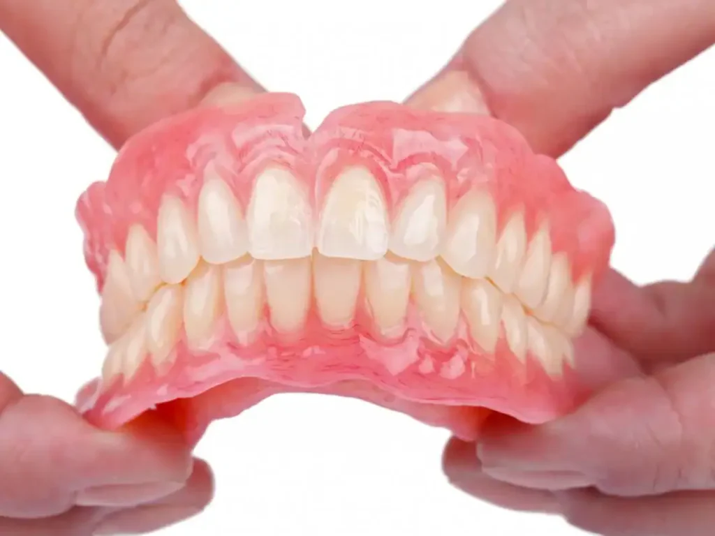 Implant-supported snap-on denture option for a full arch of missing teeth